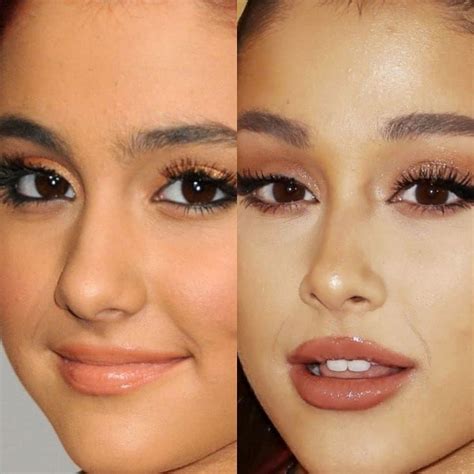 BeforeAfter on Instagram: “ARIANA GRANDE 2011 / 2018 [PART 2] # ...