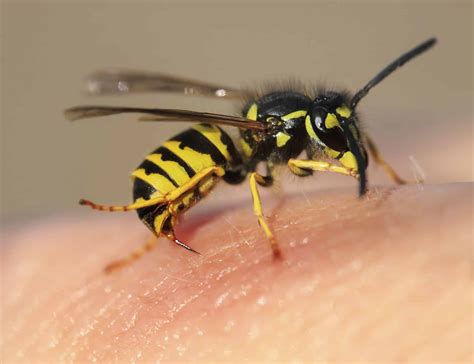 When Nature Attacks: How to Prevent and Treat Bee, Wasp or Hornet ...