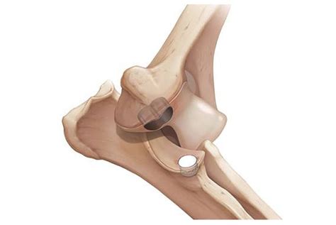 New surgical procedure for canine elbow dysplasia at Herts centre ...