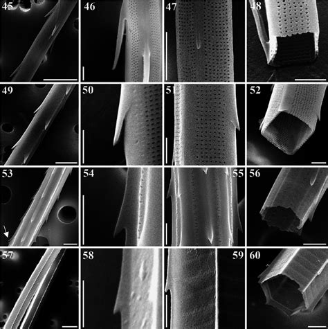 Spines and poroids on a seta of Chaetoceros danicus . SEM stub ...