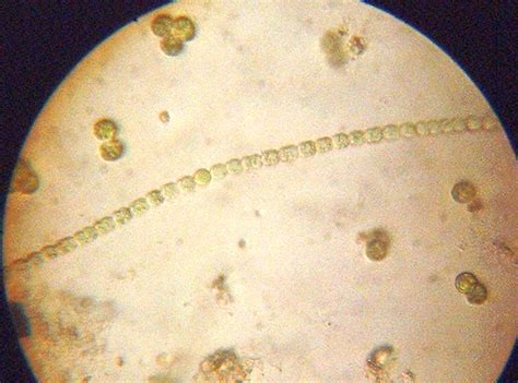 Cyanobacteria Under Microscope