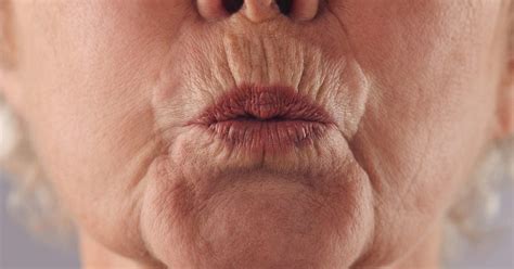 Pursed lip breathing: Benefits and how to do it