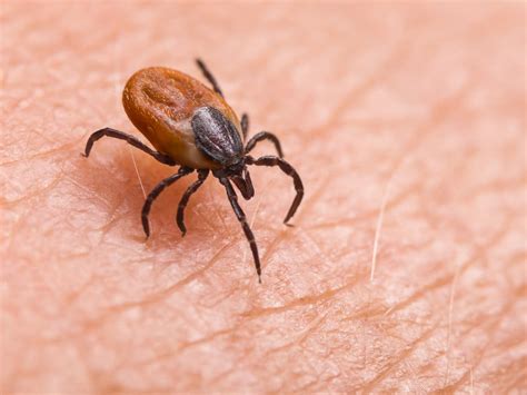 Enfermedad de Lyme y garrapatas: Información sobre cómo protegerse y ...