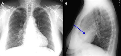 Southwest Journal of Pulmonary, Critical Care and Sleep - Imaging ...