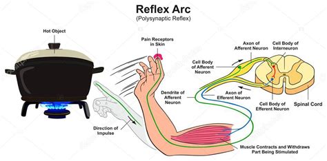 Reflex Arc Infographic Diagram Example Polysynaptic Reflex Human Hand ...