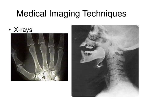 PPT - Medical Imaging PowerPoint Presentation, free download - ID:5486944