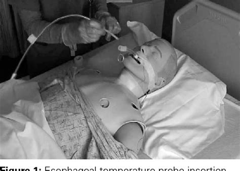 Placement of an esophageal temperature probe by nurses. | Semantic Scholar