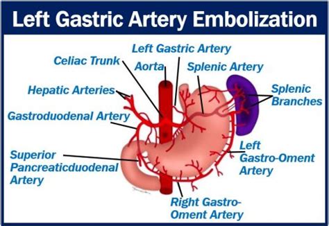 Left gastric artery embolization shrinks both fat and muscle