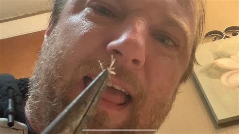 Pulling Nose Hairs with Needle Nose Pliers - YouTube