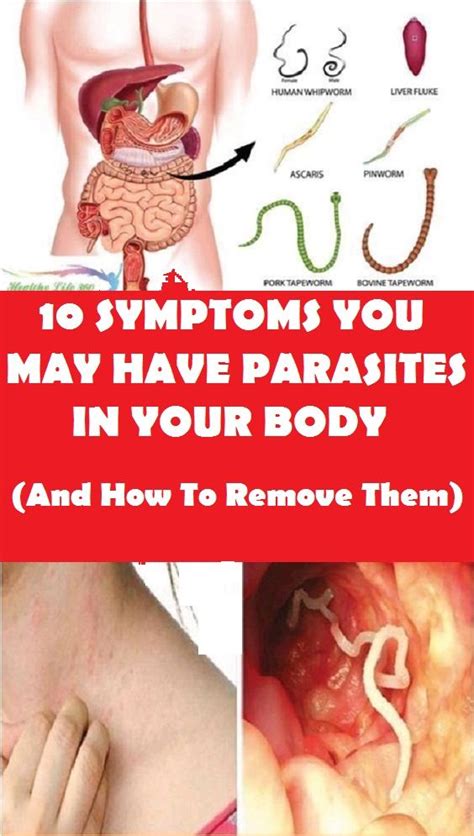 10 Symptoms You Have Parasites In Your Body And How To Remove Them ...