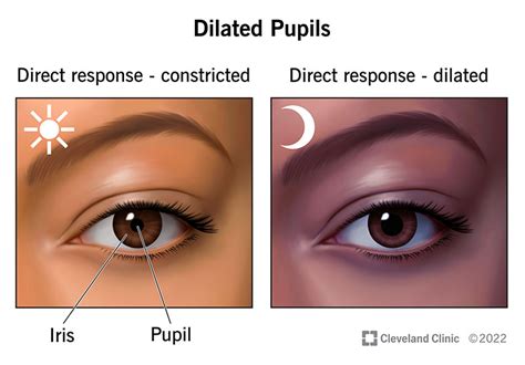 Dilated Pupils Vs Normal