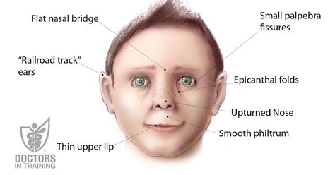 Flat Nasal Bridge And Epicanthal Folds - BK Plastic Surgery: BK Plastic ...