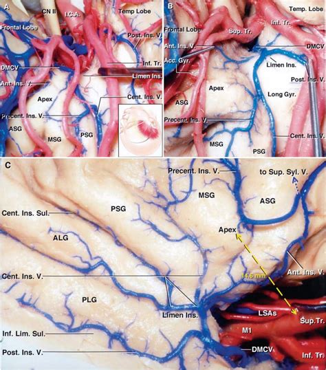 The Insula | Neuroanatomy | The Neurosurgical Atlas