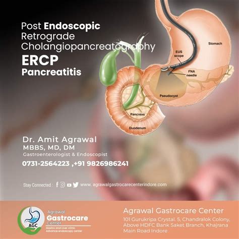 Post Endoscopic retrograde cholangiopancreatography (ERCP) Pancreatitis ...