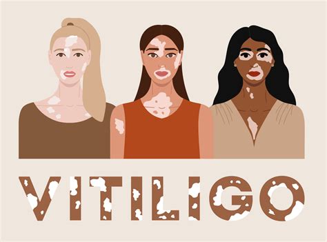 World Vitiligo Day by Maryna on Dribbble