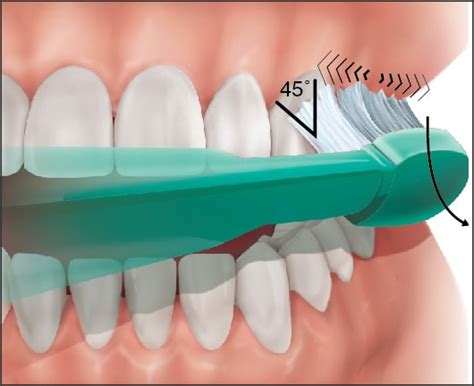 Teeth brushing: Techniques and recommended practices for proper teeth ...