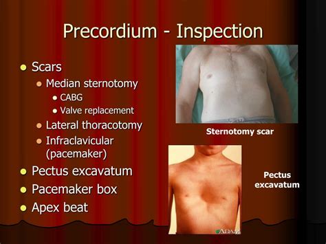 PPT - Introductory Clinical Skills Course Cardiovascular System ...