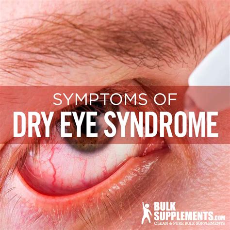 Dry Eye Syndrome Causes Symptoms Of Chronic Dry Eye