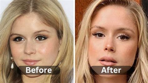 Erin Moriarty Plastic Surgery, Before & After | Myth or Reality ...