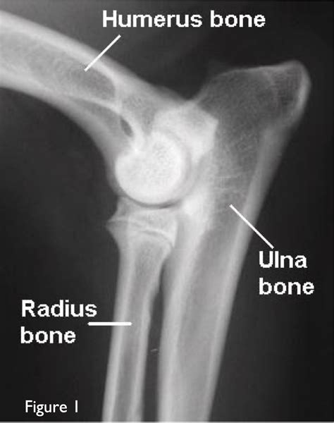 ELBOW DYSPLASIA IN DOGS - Veterinary Specialists Aotearoa | Veterinary ...