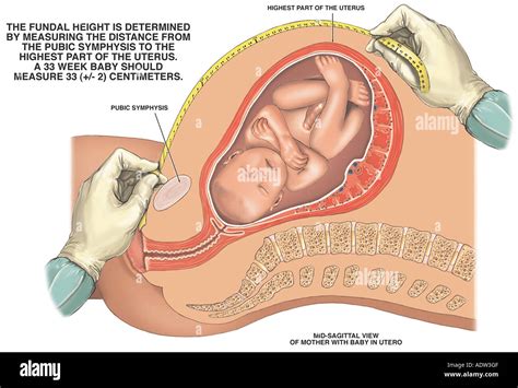 Fundus of uterus hi-res stock photography and images - Alamy