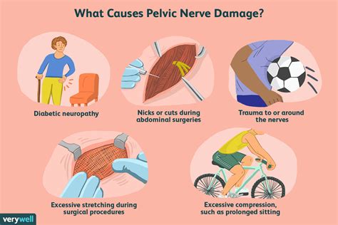 Demystifying Chronic Pelvic Pain Symptoms