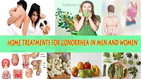 How to Deal with Gonorrhea | NATURALLY Home Treatments For Gonorrhea In ...