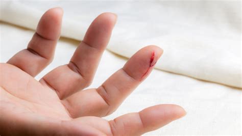 How To Tell If A Cut Is Infected Or Healing?