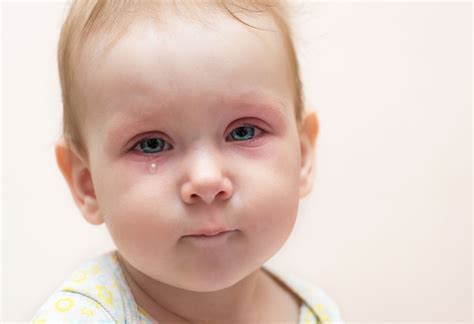 SORE EYES: Causes, Signs, Symptoms, Treatment & Prevention