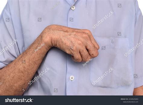 64 Abnormal Flexion Images, Stock Photos & Vectors | Shutterstock