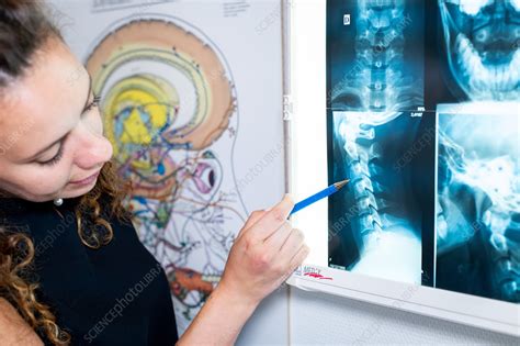 Osteopathy treatment - Stock Image - C045/8652 - Science Photo Library