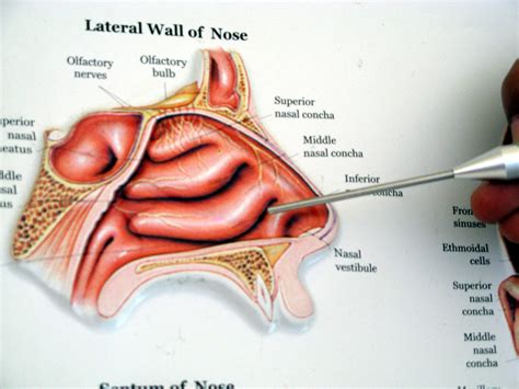 Submucous Diathermy Relieves Nasal blockage-A New method | Nasal ...