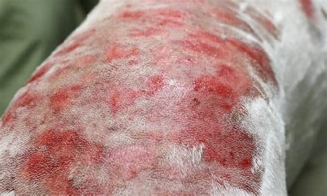 Skin Lesions On Dogs