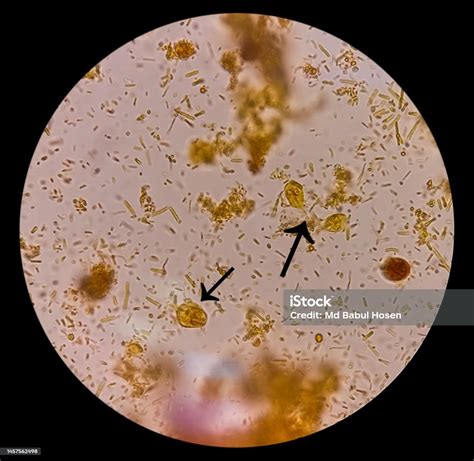 Giardia Lamblia Cysts And Trophozoite Form Muscle Fiber In Stool ...