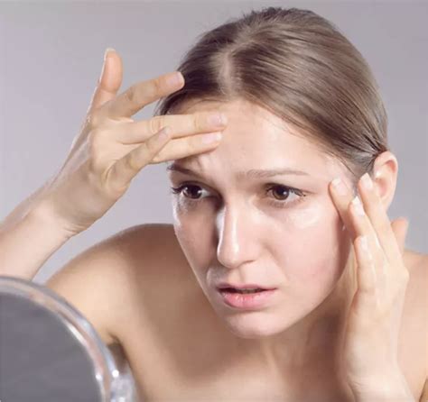 10 Best Home Remedies For Forehead Wrinkles & Prevention Tips - US What if?