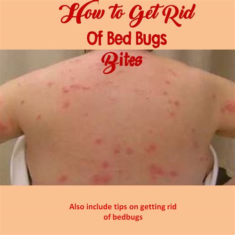 Bed Bug Bites Rash Images