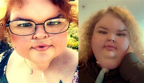 1000 Lb Sisters: Tammy Is Going BALD After Weight Loss Surgery, Facing ...