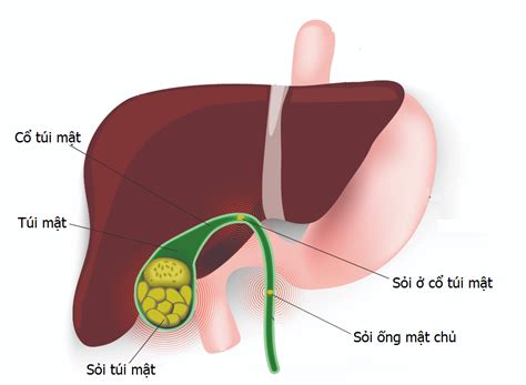 Gallbladder Sludge