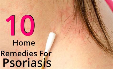 11 best Psoriasis-Anatomy images on Pinterest | Health, Psoriasis ...