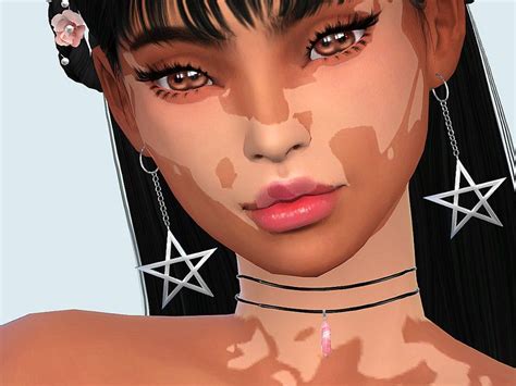 Made some more VItiligo! I actually made these a while back and just ...