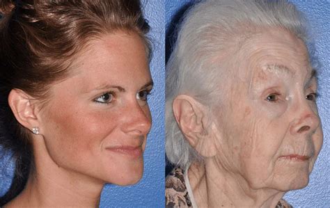 Understanding The Aging Face | Seattle Face & Skin