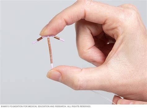 Copper Iud