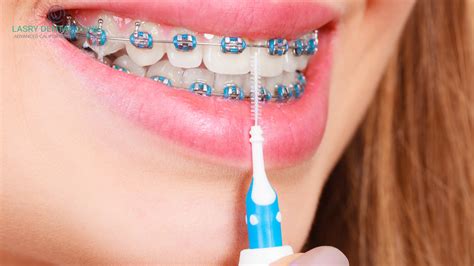 How To Brush Your Teeth with Braces: A Step-By-Step Guide