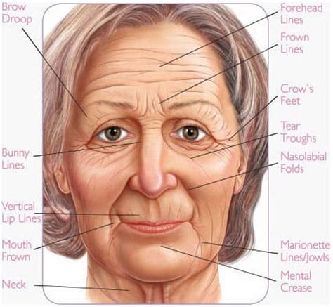 What Your Wrinkles Say About You | Glowday