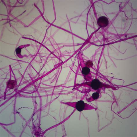 Rhizopus (Zygomycetes) Microscope Slides | Carolina.com