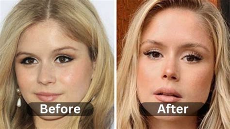 Erin Moriarty Plastic Surgery, Before & After | Myth or Reality ...