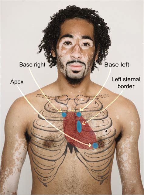 Inspection of the Precordium – Introduction to Health Assessment for ...