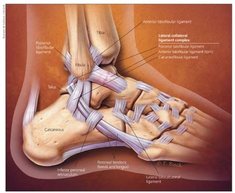 Ankle Ligament Surgery in Singapore | Orion Ortho