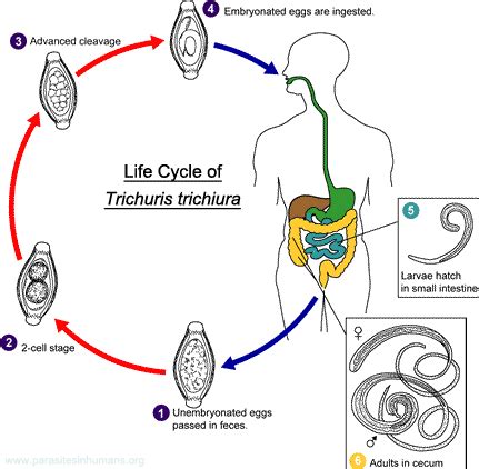 Trichuris Trichiura - Whipworm