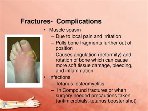 Define compound fracture - kerysmith